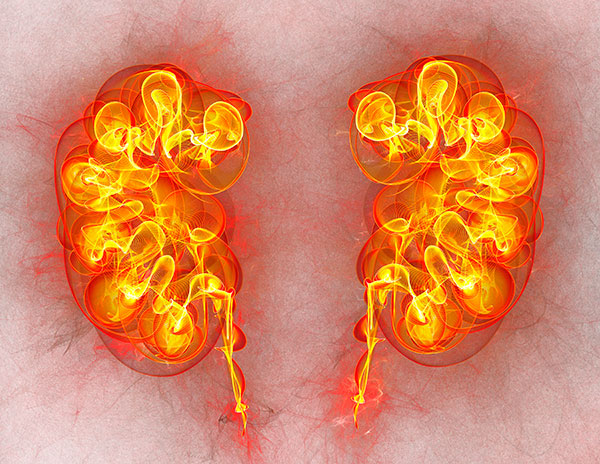 Troponin I in Kidney Disease